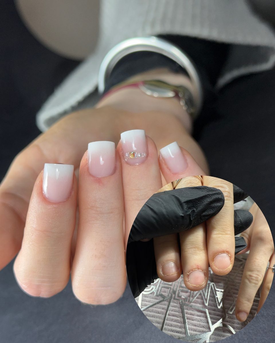 Formation Onychophagie : avant/après ongles rongés